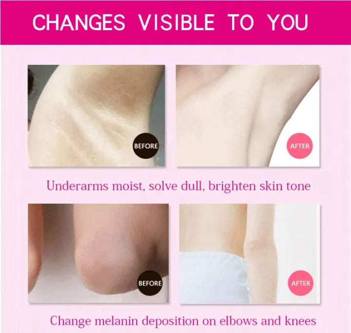 Aichun Beauty Magic White 7 In 1 Yogurt and Milk Under Arm Cream - 80g victoriastore.com.pk