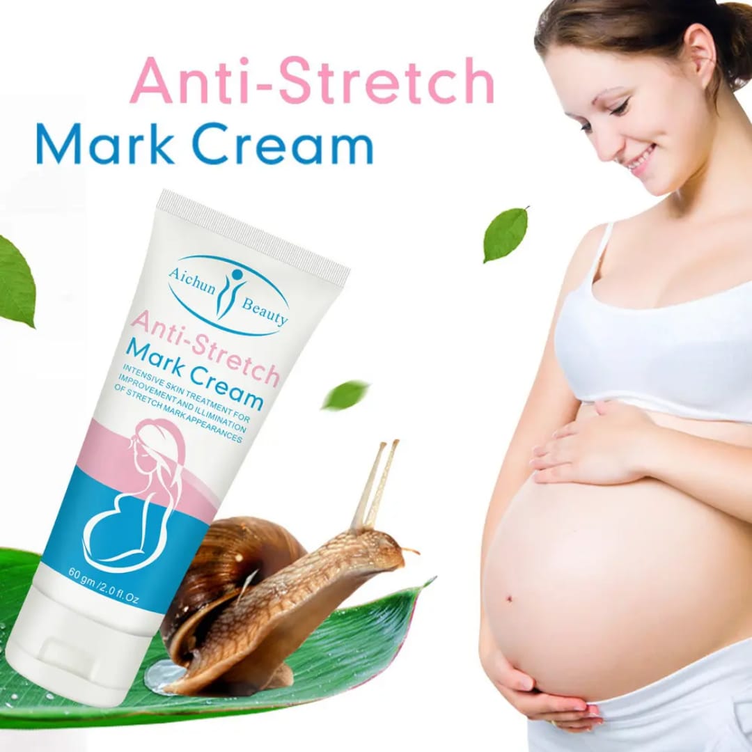 Anti Stretch Mark Cream – Skin Repair & Firming victoriastore.com.pk