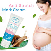 Anti Stretch Mark Cream – Skin Repair & Firming victoriastore.com.pk