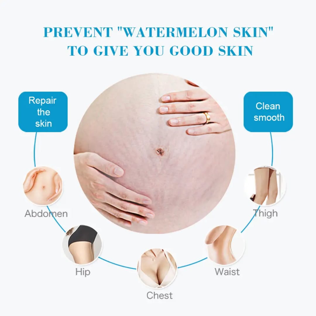 Anti Stretch Mark Cream – Skin Repair & Firming victoriastore.com.pk