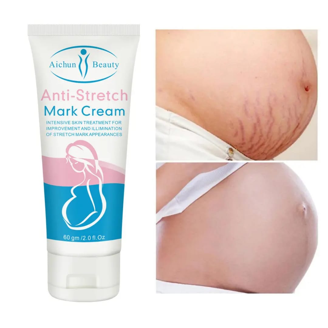 Anti Stretch Mark Cream – Skin Repair & Firming victoriastore.com.pk