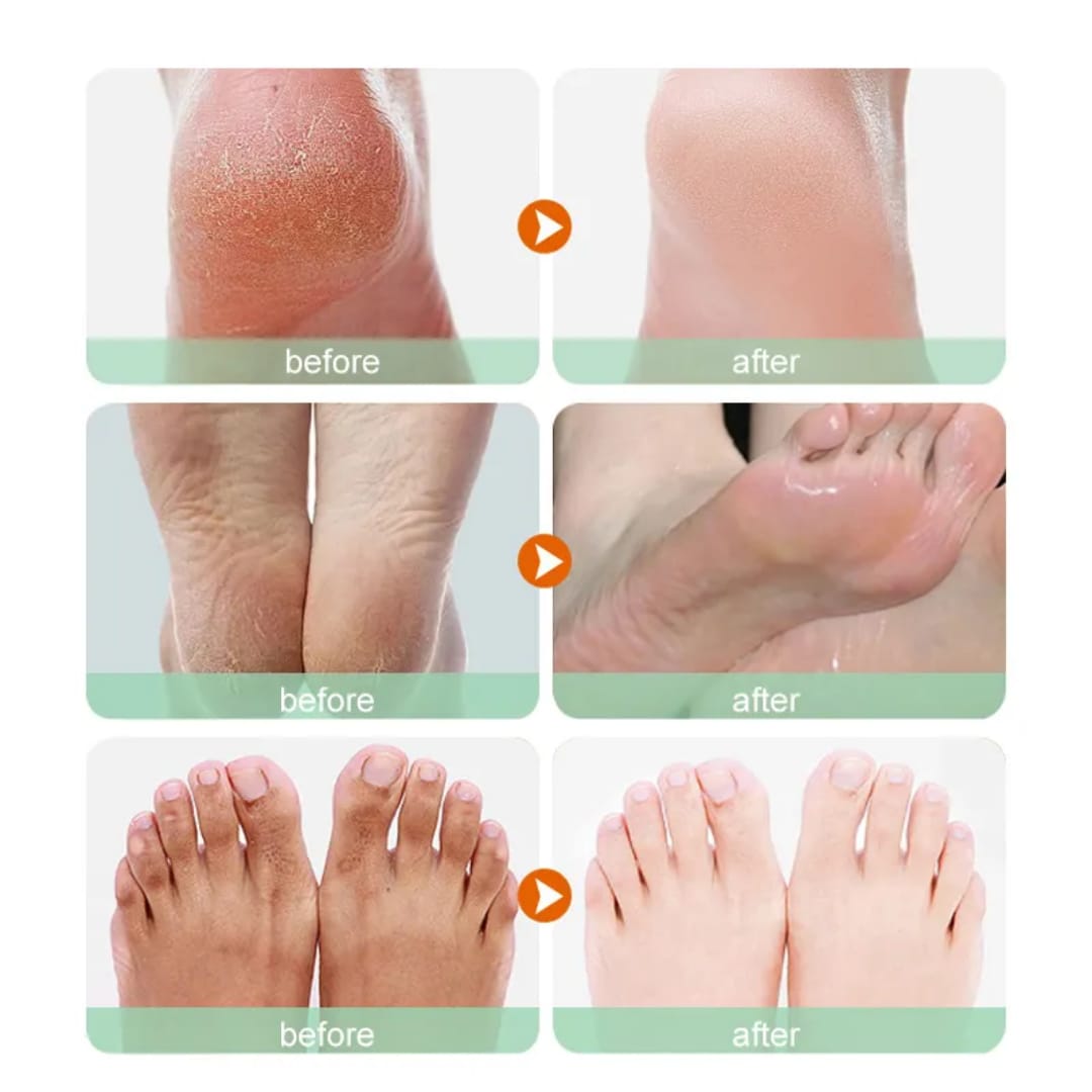 Milk Foot Mask – Hydrating & Softening Foot Care victoriastore.com.pk