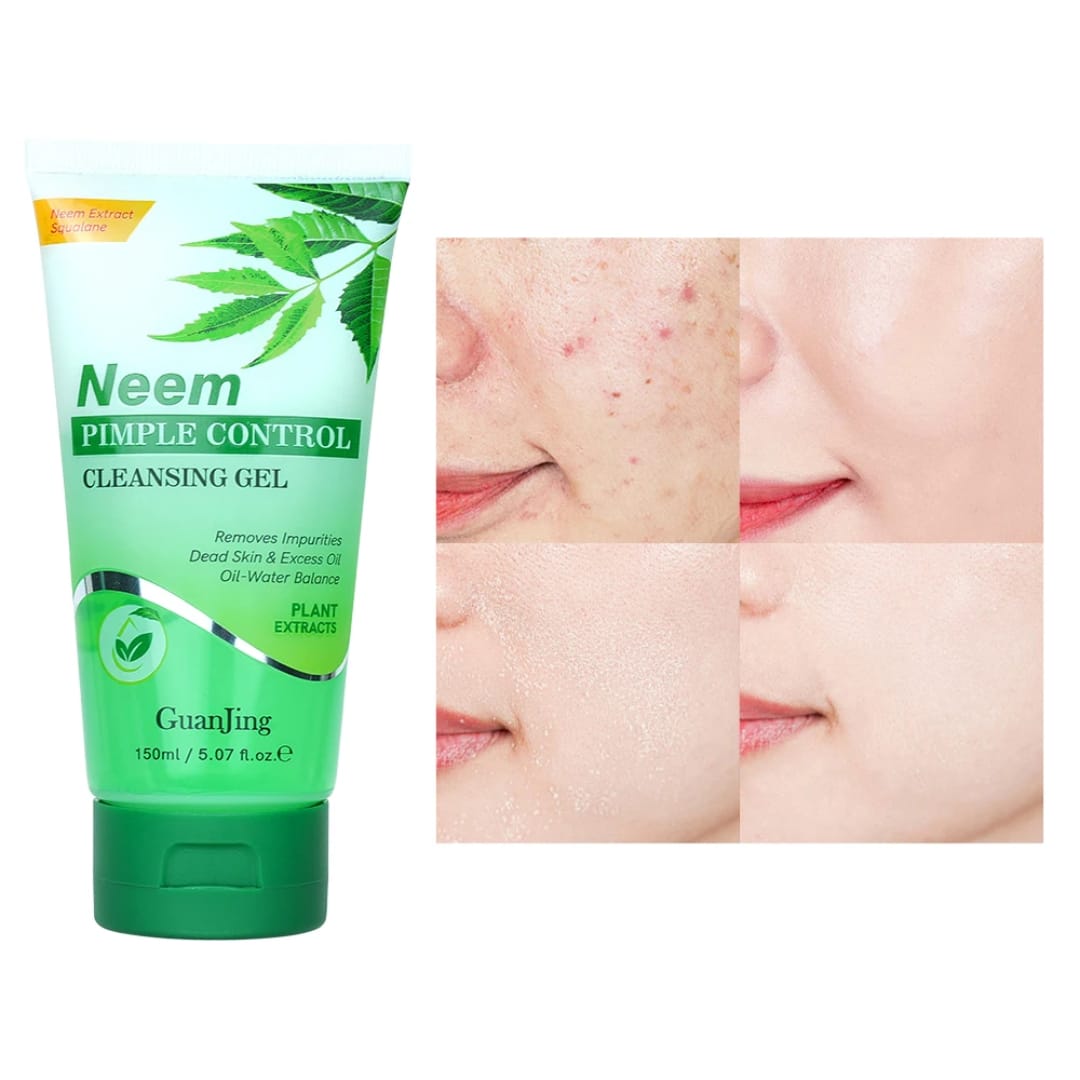 Neem Pimple Control Cleansing Gel for Acne-Free Skin victoriastore.com.pk