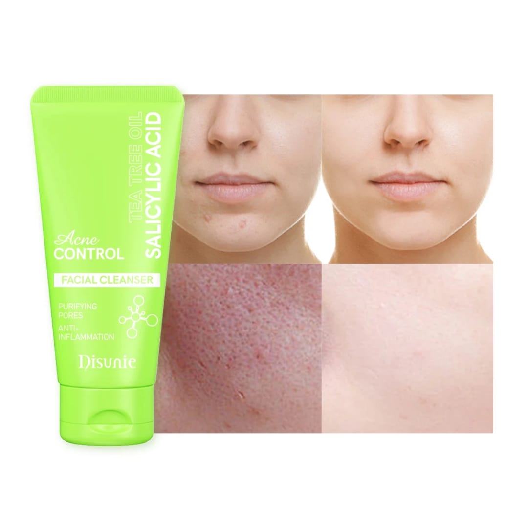 Salicylic Acid Acne Control Face Cleanser victoriastore.com.pk