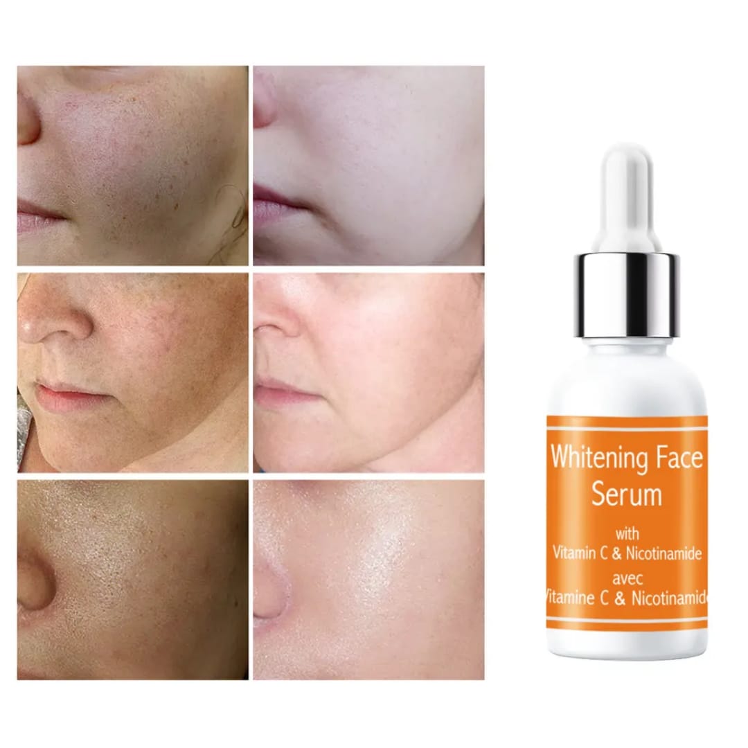 Vitamin C & Niacinamide Brightening Face Serum victoriastore.com.pk