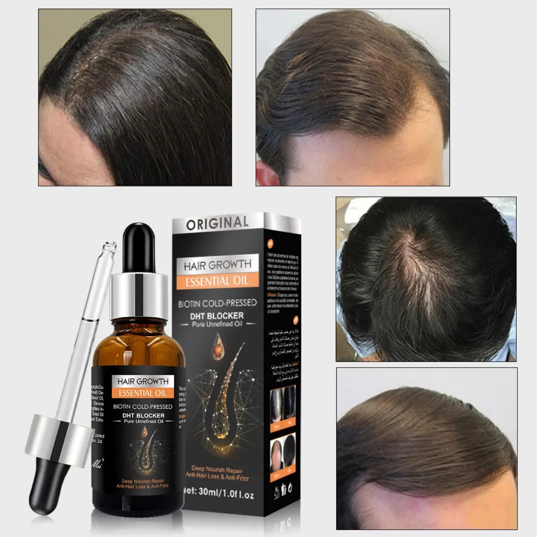 Hair Growth Essential Oil Biotin DHT Blocker 30ml